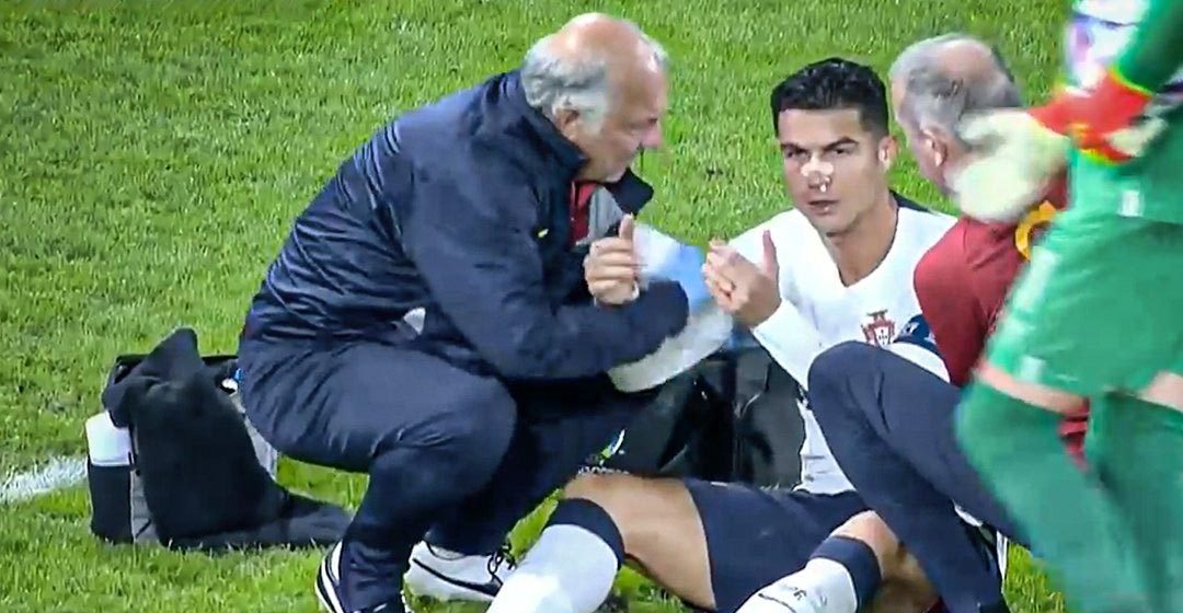 Cristiano Ronaldo sufrió fuerte golpe durante partido