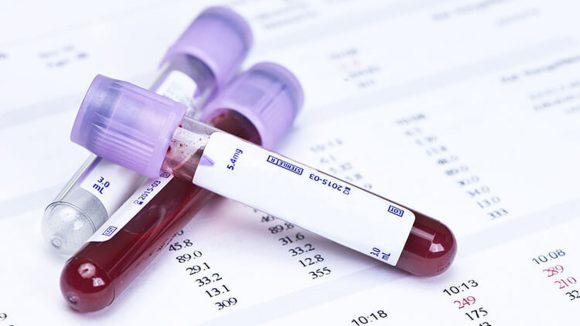 Análisis de sangre pudiera detectar cáncer antes de tener síntomas
