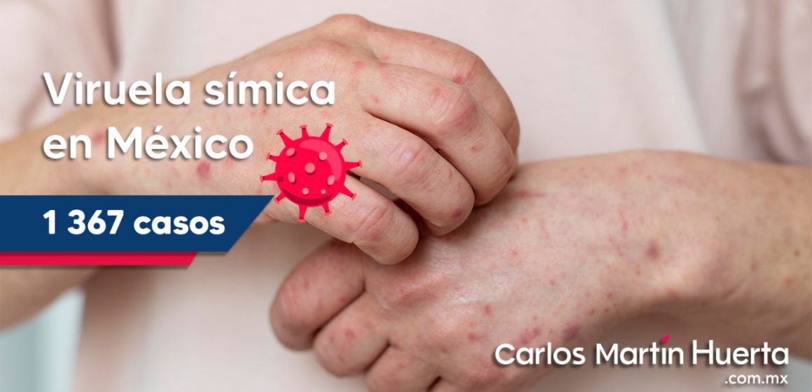 México suma mil 367 casos de viruela símica