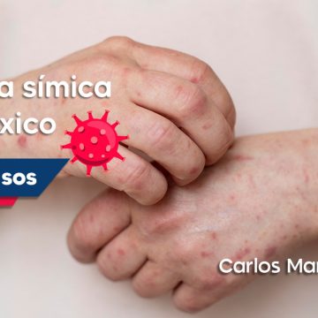 México suma mil 367 casos de viruela símica