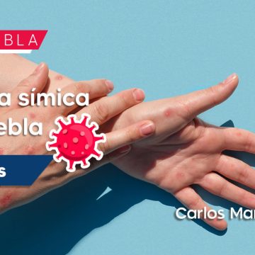 En Puebla se han registrado 10 casos de viruela símica