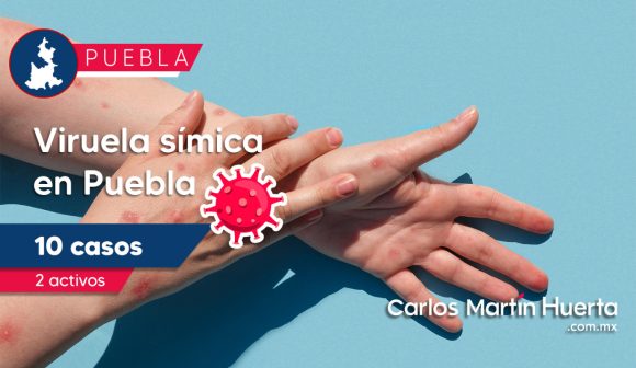 En Puebla se han registrado 10 casos de viruela símica