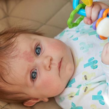 ¿Porqué nacen algunos bebés con una mancha en la frente?