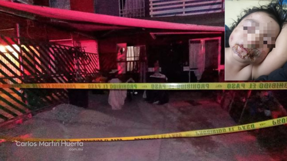 Linchan a individuo que quemó la cara a bebé de 2 años en SLP