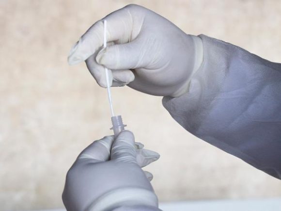 8842f0983bda612e82add9a8c293206c_L Continúa Puebla sin fallecimientos a causa de la COVID-19: Salud