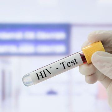 Cofepris expide autorización a autoprueba para diagnóstico de VIH