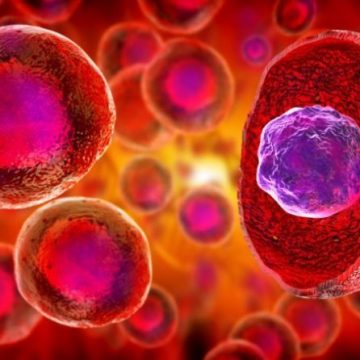 Mujer se cura de VIH gracias a células madre de cordón umbilical