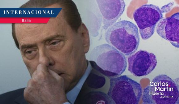 Silvio Berlusconi diagnosticado con leucemia