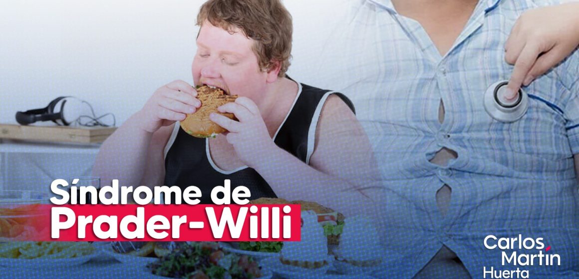 Hambre insaciable: El Síndrome de Prader-Willi