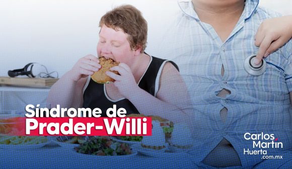 Hambre insaciable: El Síndrome de Prader-Willi