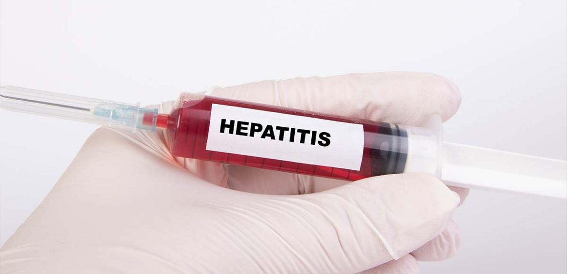 Hepatitis podría matar más personas que la malaria, tuberculosis y VIH