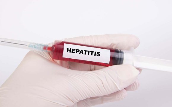 hepatitis-sintomas-unam Hepatitis podría matar más personas que la malaria, tuberculosis y VIH