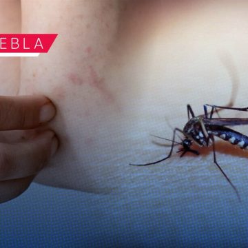 Puebla suma 60 nuevos casos de dengue en 24 horas