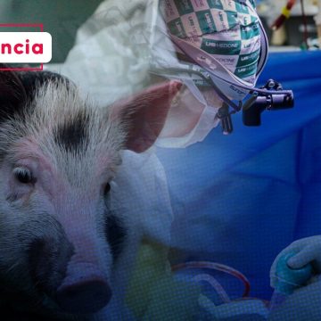 Trasplante de riñones de cerdo a humano son funcionales   