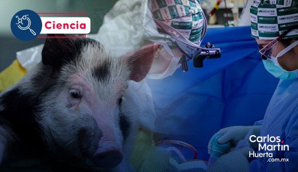 Trasplante de riñones de cerdo a humano son funcionales   