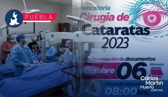 Serán 336 poblanos los que volverán a ver; como aplicar para cirugía de cataratas gratuita