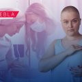 Día contra el Cáncer de Mama: ¿Por qué la detección temprana es urgente?