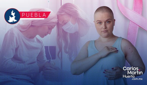 Día contra el Cáncer de Mama: ¿Por qué la detección temprana es urgente?