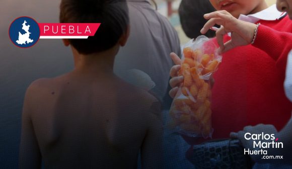 El 40% de los niños sufren desnutrición en la Ciudad de Puebla; el 30% tiene sobrepeso