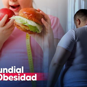 La obesidad se puede prevenir en 4 pasos