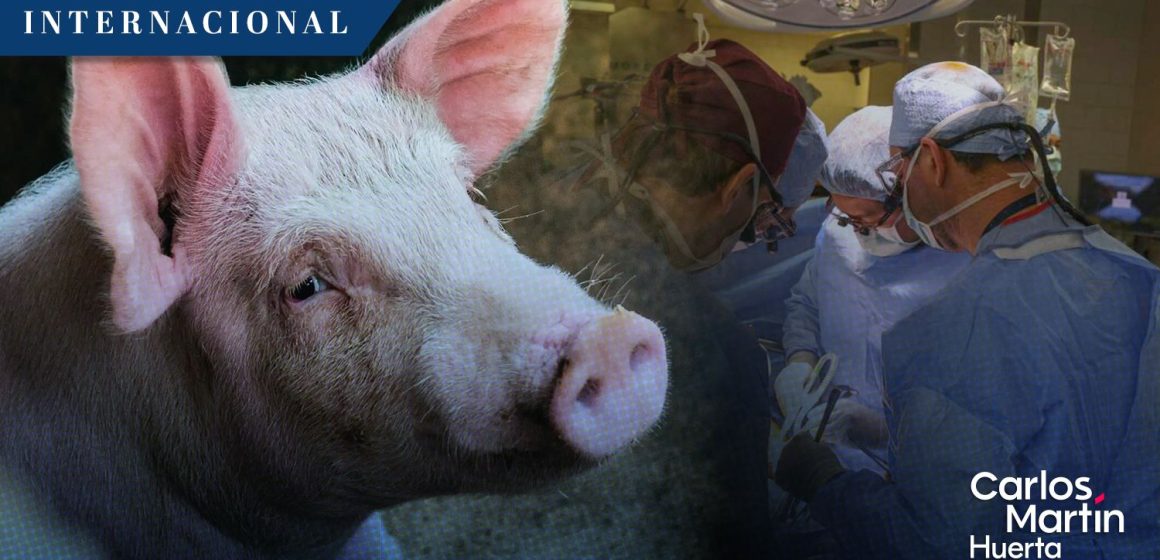 Trasplantan con éxito riñón de cerdo a paciente vivo en EE.UU