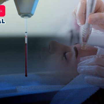 Por facial ‘vampiro’ hay tres mujeres contagiadas de VIH en EE.UU