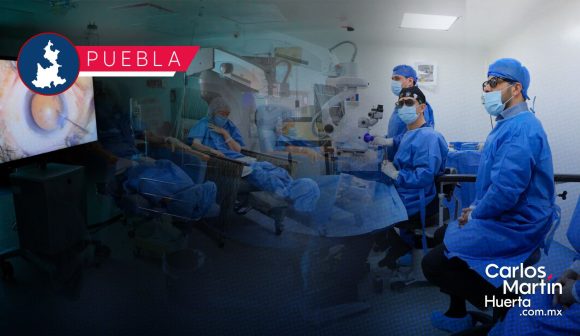 Más de 300 poblanos volverán a ver gracias al programa ‘Contigo Veremos Más’