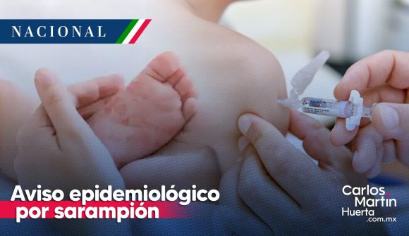 Aviso epidemiologico por sarampión en México: SSA