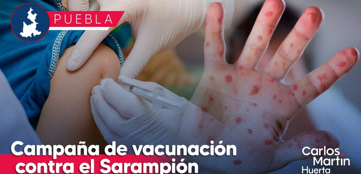 Sigue activa campaña de vacunación contra el sarampión en Puebla