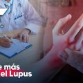 Conoce más sobre el Lupus; Ayuntamiento de Atlixco realizará jornada de salud