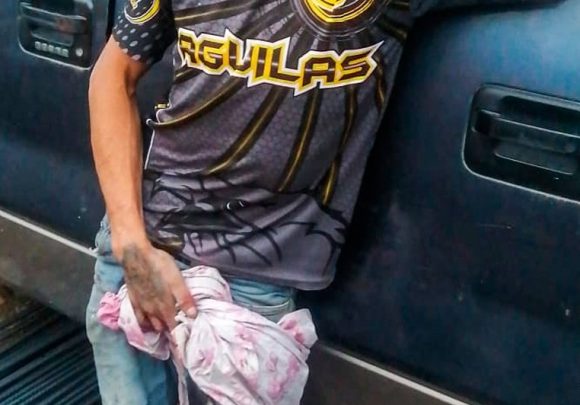 Policías de Amozoc golpean y balean a trabajador del Metrobús