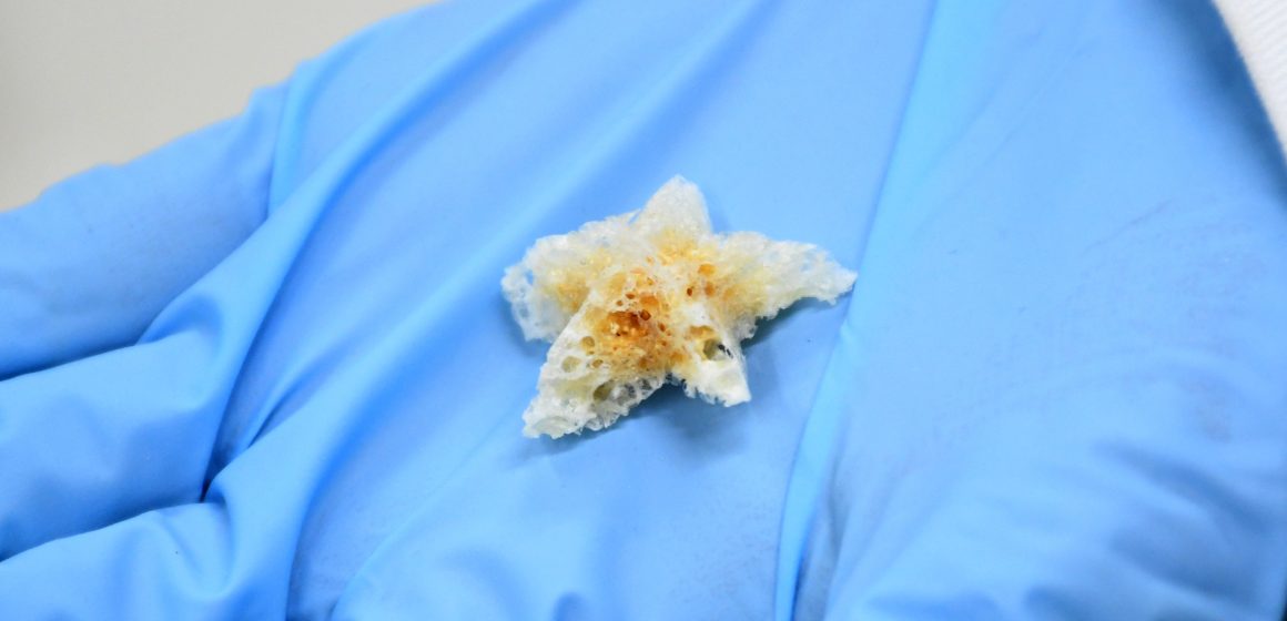 En la BUAP se crean esponjas biodegradables y nanofibras poliméricas para la regeneración ósea
