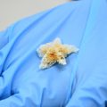En la BUAP se crean esponjas biodegradables y nanofibras poliméricas para la regeneración ósea