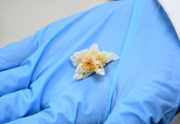 En la BUAP se crean esponjas biodegradables y nanofibras poliméricas para la regeneración ósea