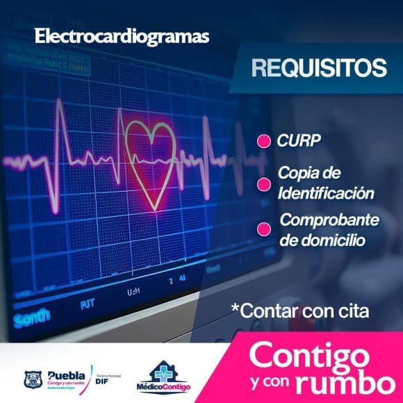 Invita SMDIF a realizarse un electrocardiograma