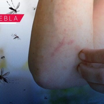 Concentran 5 municipios el 60.3% de los casos de dengue en Puebla