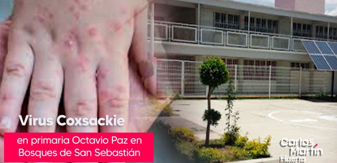 Alerta por virus Coxsackie en primaria de Bosques de San Sebastián