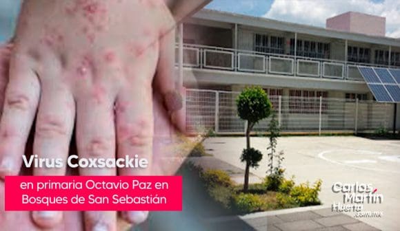 Alerta por virus Coxsackie en primaria de Bosques de San Sebastián