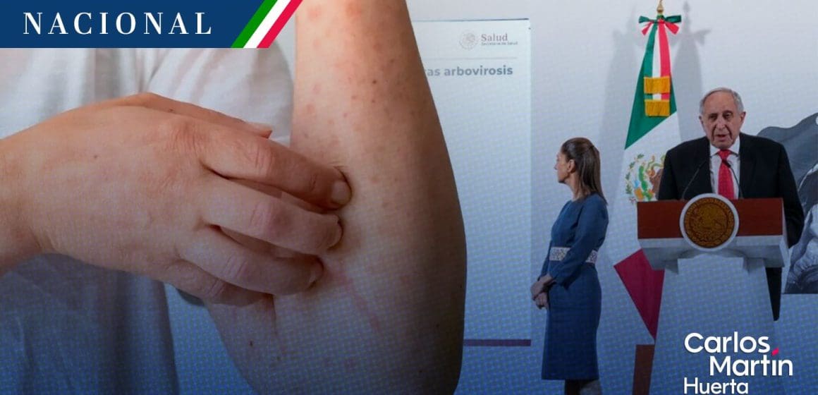 Salud presenta Plan Nacional contra el Dengue; se busca desarrollar vacuna