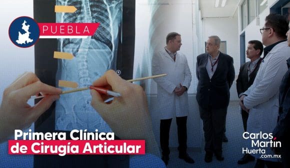 Puebla abrirá su primera Clínica de Cirugía Articular