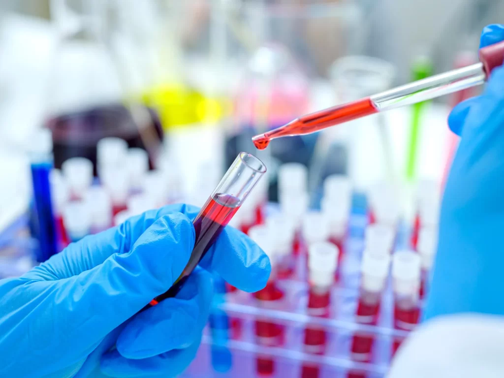 Avance médico: Análisis de sangre podría detectar cáncer hasta tres años antes 2 Avance medico Analisis de sangre podria detectar cancer hasta tres anos antesAvance medico Analisis de sangre podria detectar cancer hasta tres anos antes 3