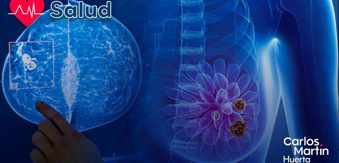 Nuevo avance contra el cáncer de mama: TIM-3, el talón de Aquiles de las células metastásicas