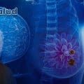 Nuevo avance contra el cáncer de mama: TIM-3, el talón de Aquiles de las células metastásicas