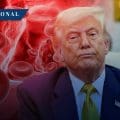 Trump diagnosticado con insuficiencia venosa crónica: Casa Blanca