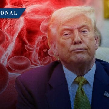 Trump diagnosticado con insuficiencia venosa crónica: Casa Blanca