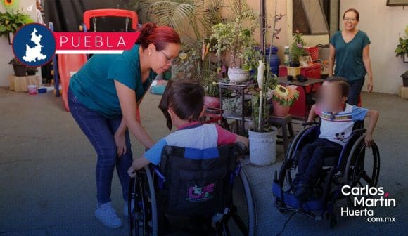 Mejoran la calidad de vida de Matías, un niño con hidrocefalia