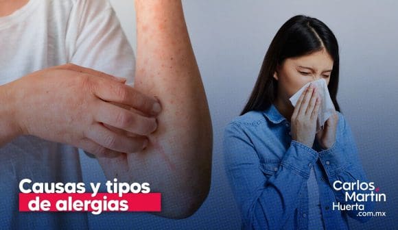 Día Internacional de las Alergias: causas, tipos más comunes y cómo prevenirlas