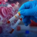 Avance médico: Análisis de sangre podría detectar cáncer hasta tres años antes