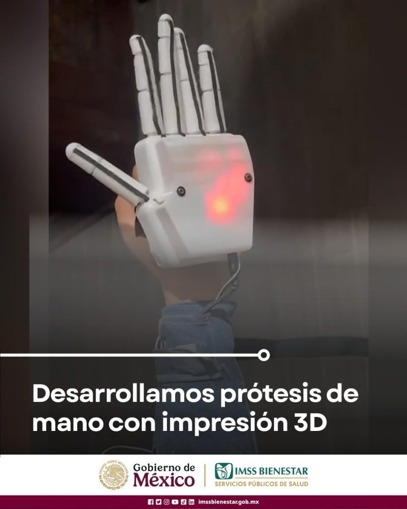 Joven de 22 años recibe prótesis de mano en 3D en hospital IMSS-Bienestar 1 GyWAvfqXwAEBlij