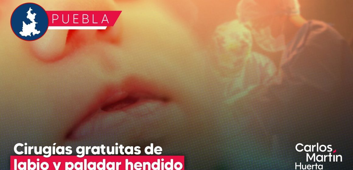 Nueva jornada de cirugías gratuitas para labio y paladar hendido en Puebla